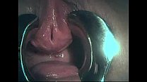 Urethra Fingering sex
