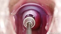 Pussy Speculum sex