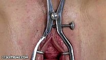 Mature Gyno sex