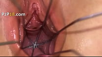 Czech Gyno sex