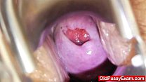 Mature Gyno sex