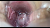 Vaginal sex