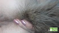 Anal Hairy sex