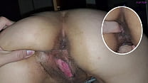 Finger In Asshole sex