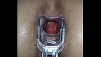 Speculum sex