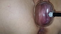 Pumped Pussy Lips sex