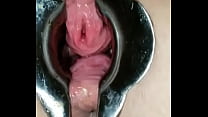 Urethral sex