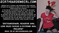 Anal Extreme sex