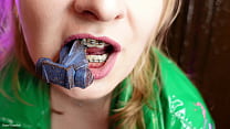 Zahnspange sex