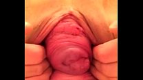 Pussy Prolapse sex