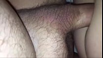 Dick Hairy sex