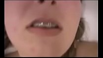 Teen With Braces sex