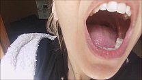 Bad Teeth sex