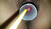 Amateur Cervix Porn sex