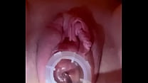 Uterus sex
