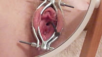 Urethral Sounding sex