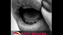 Girl With Braces sex