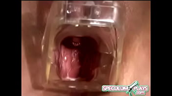Speculum sex