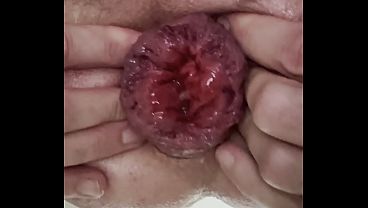 Prolaps sex