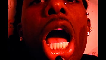 カテーテル video