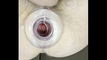 Huge Anal Gape sex