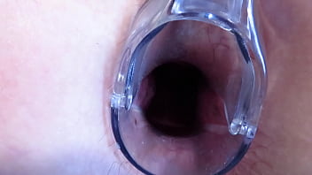 Speculum sex