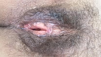 Fisting Vaginal sex