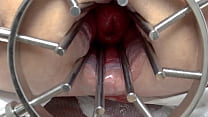 Speculum sex