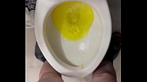 Mijo sex