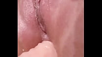 Masturbation Anal sex