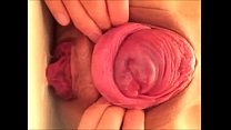 Cervix sex